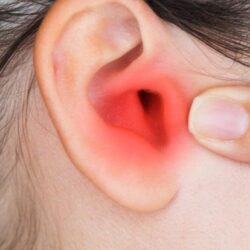 Akut Kulak İltihapları Akut Kulak İltihapları