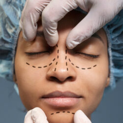 Deviasyon Ameliyatı Deviasyon Ameliyatı