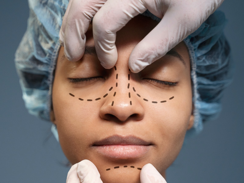 Deviasyon Ameliyatı