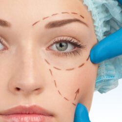 Göz Kapağı Estetiği Göz Kapağı Estetiği