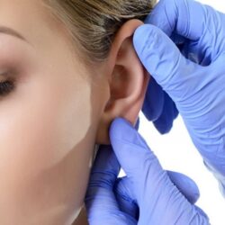 Kepçe Kulak Ameliyatı Kepçe Kulak Ameliyatı